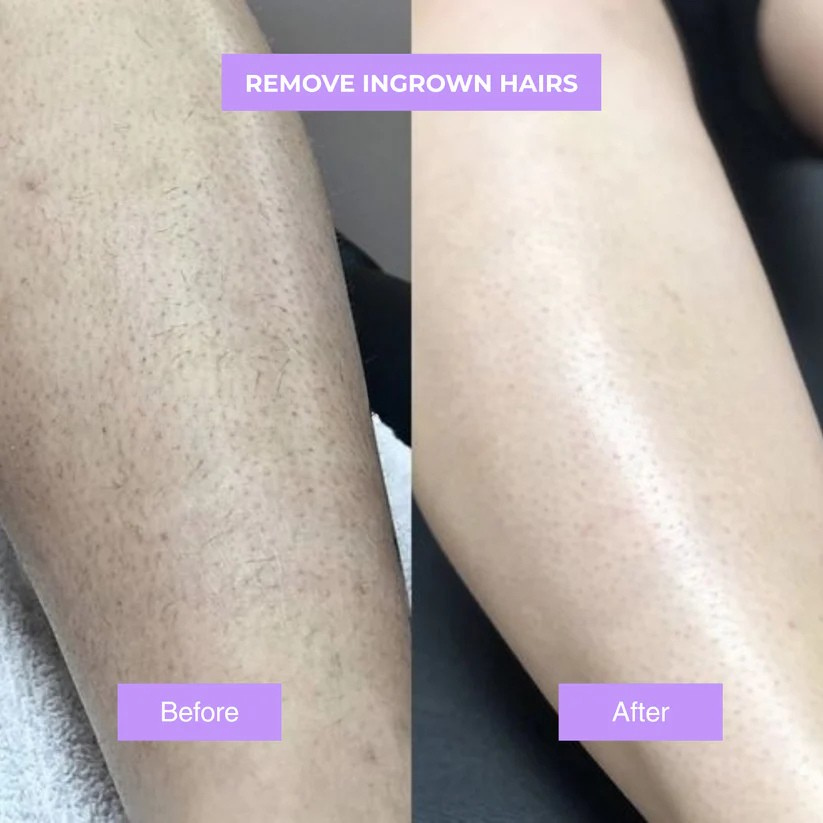 Cyphera™ - Cyperus Rotundus Skin Serum