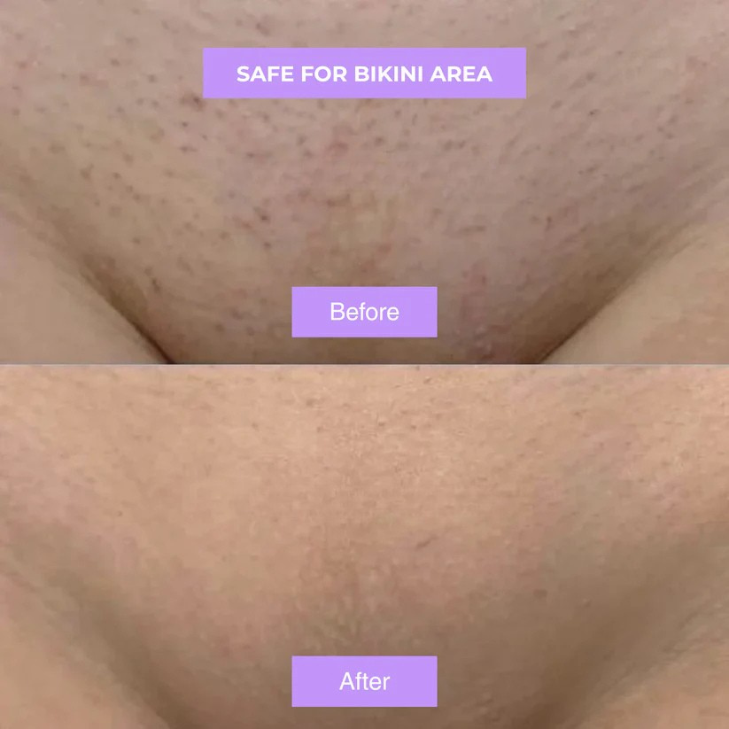 Cyphera™ - Cyperus Rotundus Skin Serum
