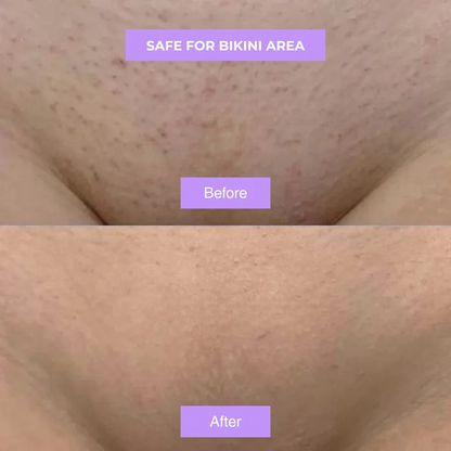 Cyphera™ - Cyperus Rotundus Skin Serum